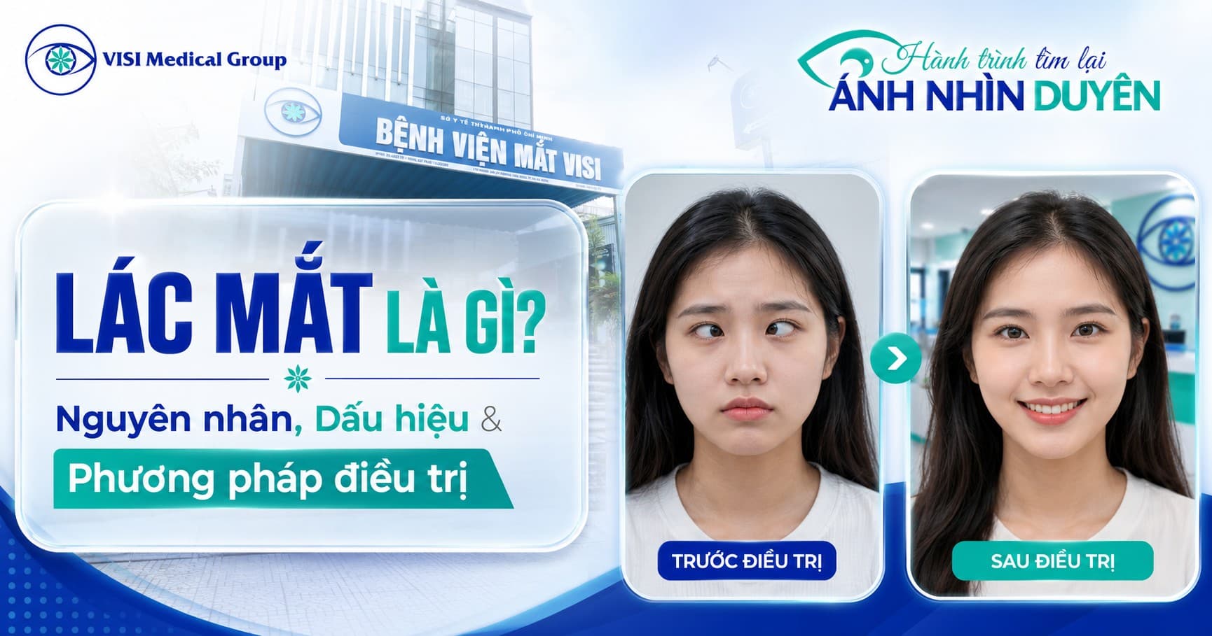 Lác mắt là gì? Nguyên nhân, dấu hiệu và phương pháp điều trị - VISI